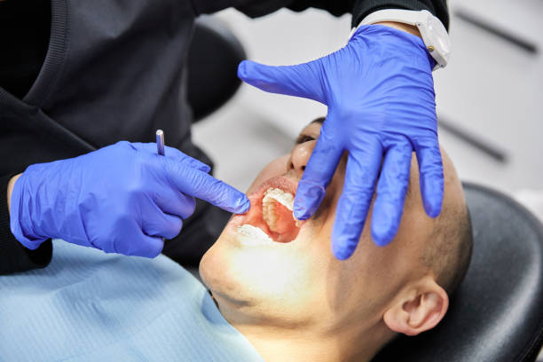 Best Dentist for Tooth Abscess  in Independence, OH