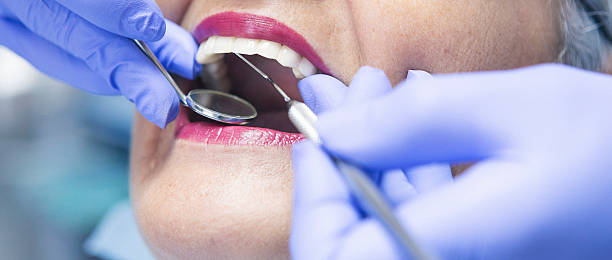 Tooth Infection Emergency Dentist in OH